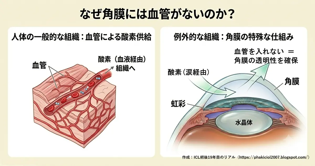 角膜の酸素供給の仕組み｜ICL術後19年目のリアル